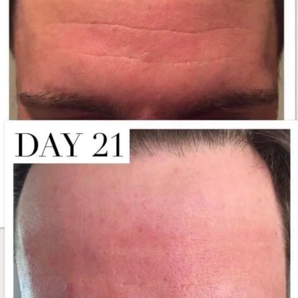 Nu Skin Tru Face Line Corrector Serum - Picture 2 of 6